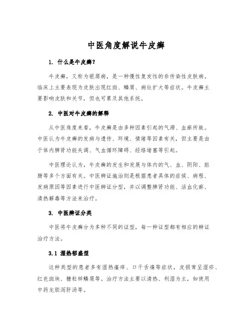 中医角度解说牛皮癣