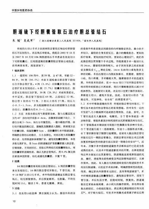 胆道镜下经胆囊管取石治疗胆总管结石
