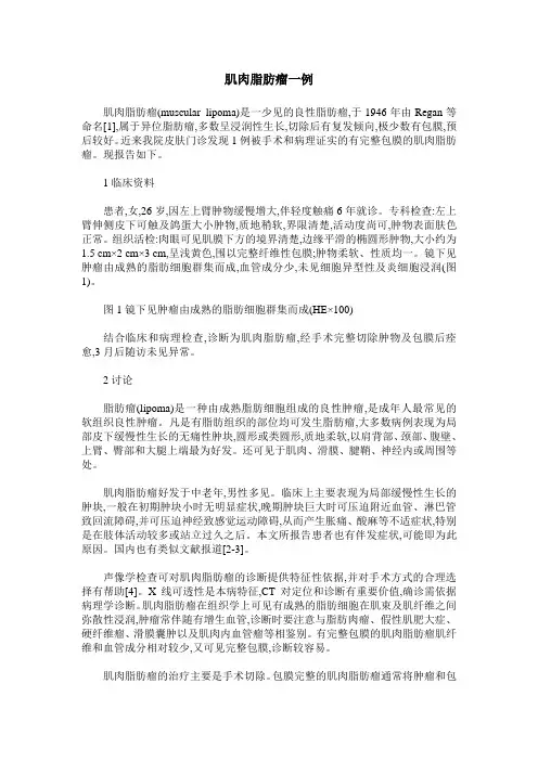 肌肉脂肪瘤一例