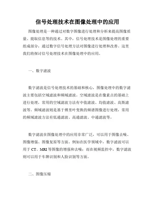 信号处理技术在图像处理中的应用