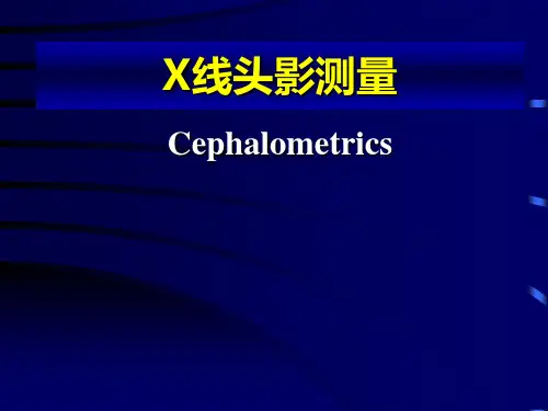 口腔正畸学 X线头影测量