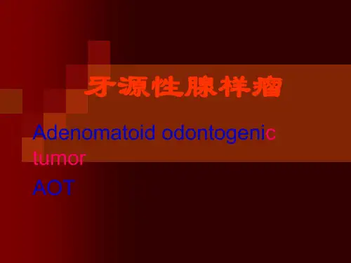 牙源性腺样瘤汇总