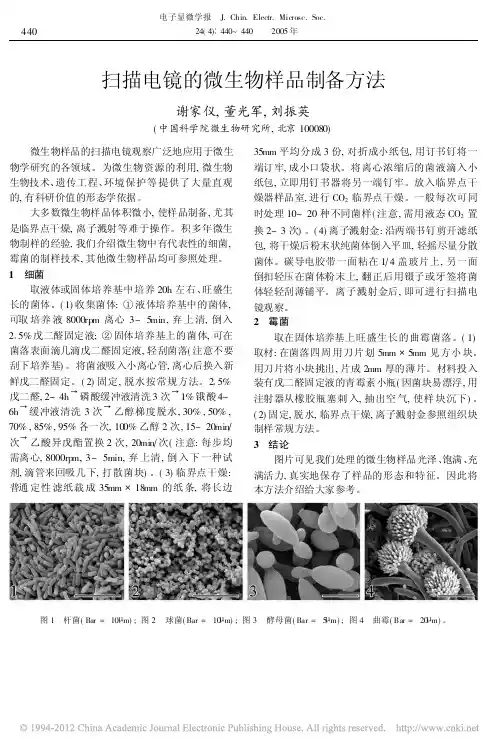 扫描电镜的微生物样品制备方法