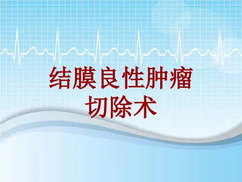 手术讲解模板：结膜良性肿瘤切除术