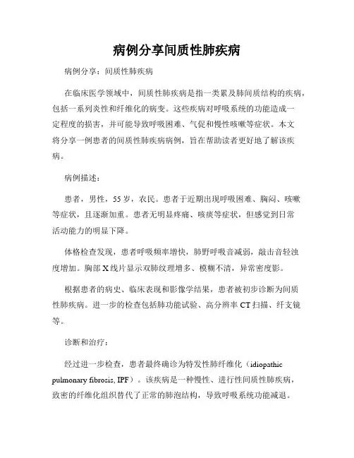 病例分享间质性肺疾病