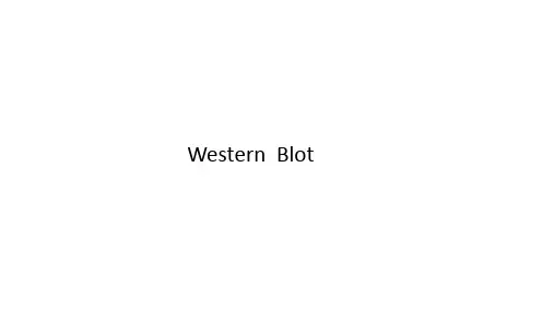 (完整版)westernblot原理及操作