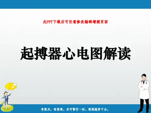 起搏器心电图解读PPT