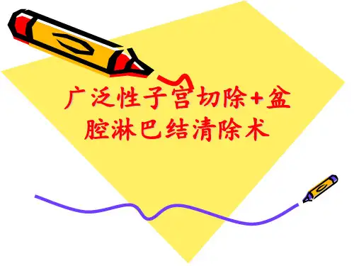广泛性子宫切除+盆腔淋巴结清除-精品文档