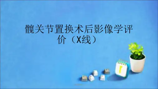 髋关节置换影像评价ppt课件