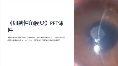 《细菌性角膜炎》课件