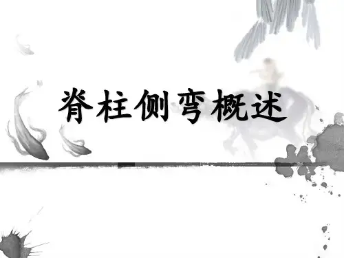 脊柱侧弯概述PPT课件