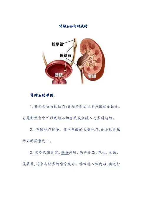 肾结石如何形成的