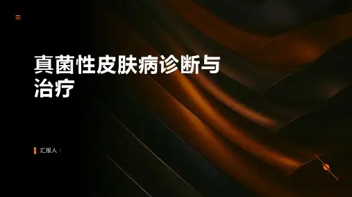 真菌性皮肤病诊断与治疗PPT
