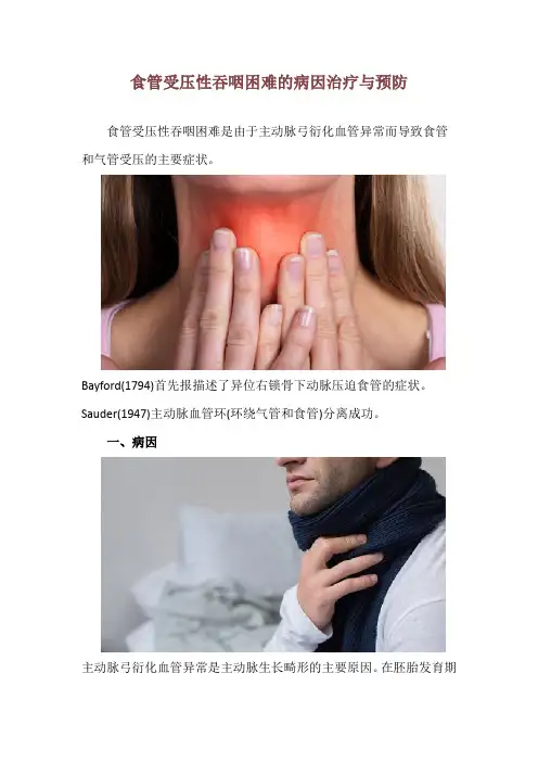 食管受压性吞咽困难的病因治疗与预防