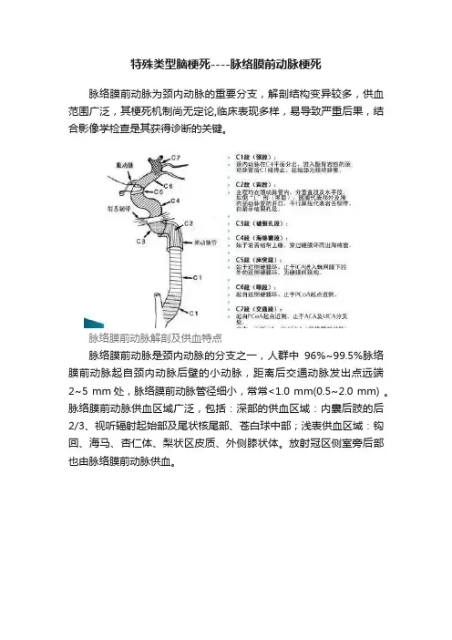 特殊类型脑梗死----脉络膜前动脉梗死