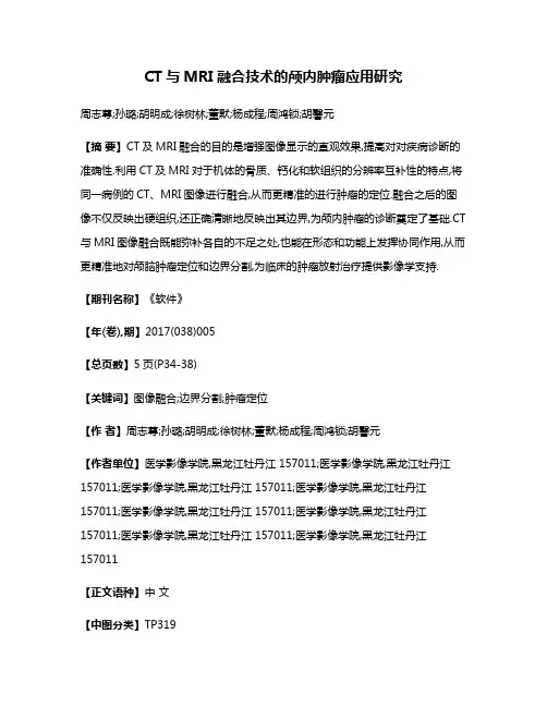 CT与MRI融合技术的颅内肿瘤应用研究