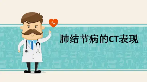 肺结节病的CT表现-PPT精品课件