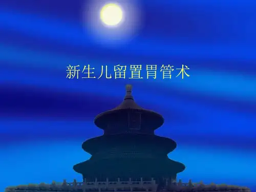 新生儿胃管留置术