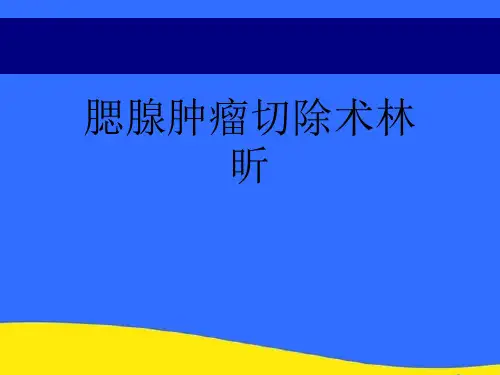 【优选】腮腺肿瘤切除术林昕PPT资料