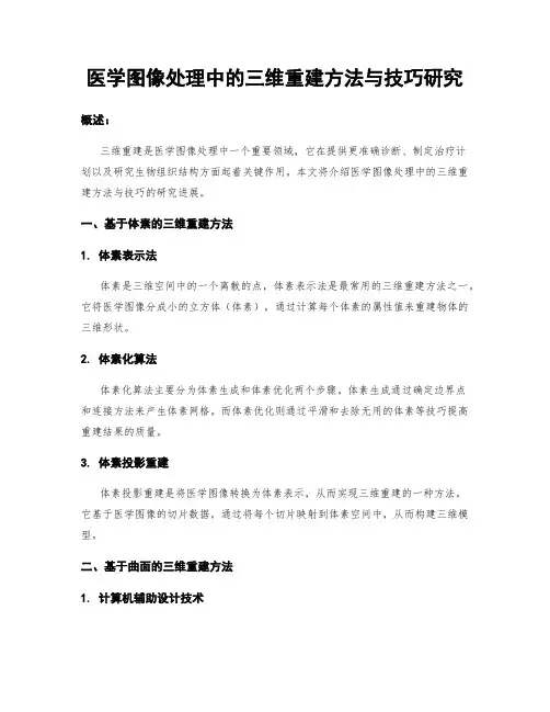 医学图像处理中的三维重建方法与技巧研究