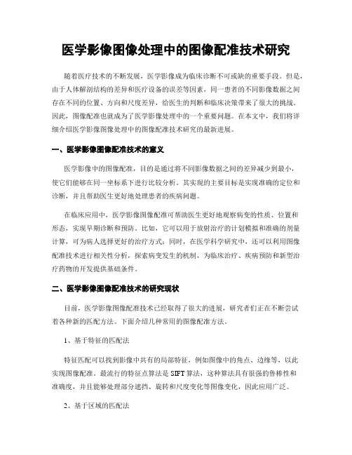 医学影像图像处理中的图像配准技术研究
