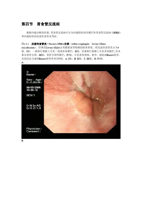 消化内镜诊断图谱胃食管反流病