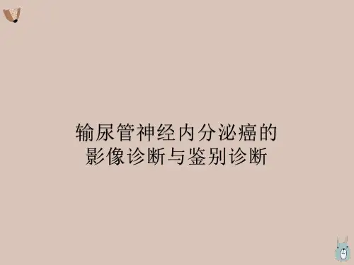 输尿管神经内分泌癌的影像诊断与鉴别诊断