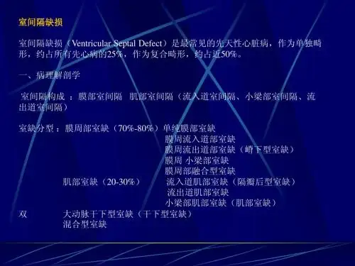 室间隔缺损B5DAC1F9D5C2