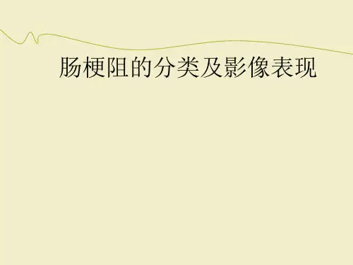 肠梗阻的影像诊断ppt课件(1)