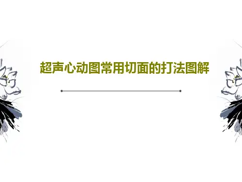 超声心动图常用切面的打法图解共53页