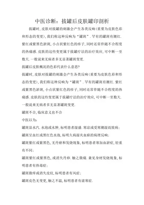 中医诊断：拔罐后皮肤罐印分析