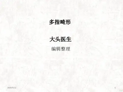 多指畸形PPT课件