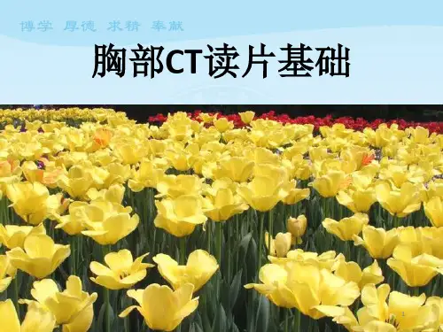 胸部CT读片基础PPT课件