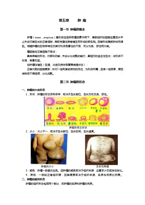 《肿瘤》教案