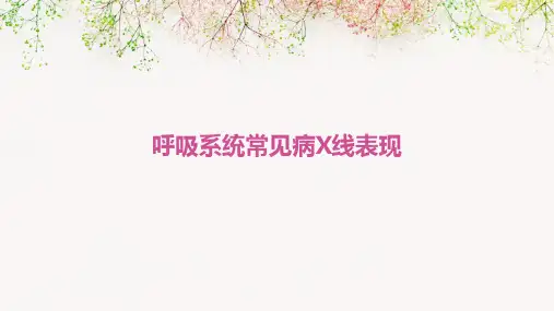 呼吸系统常见病X线表现