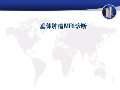垂体肿瘤MRI诊断 (NXPowerLite)幻灯片课件