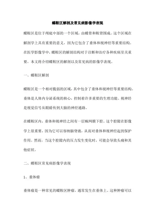 蝶鞍区解剖及常见病影像学表现