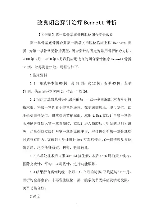 改良闭合穿针治疗Bennett骨折