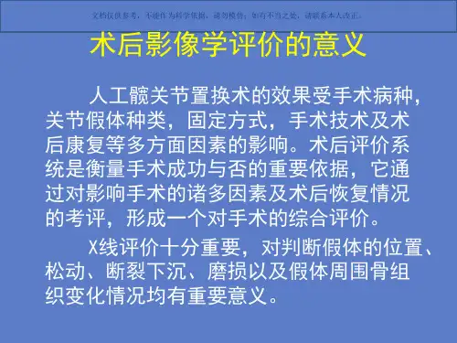 髋膝关节置换术后X线评价课件