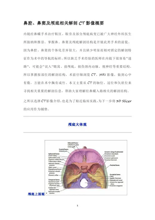 鼻腔、鼻窦及颅底相关解剖CT影像概要