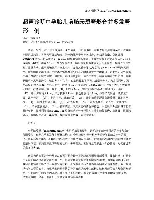 超声诊断中孕胎儿前脑无裂畸形合并多发畸形一例