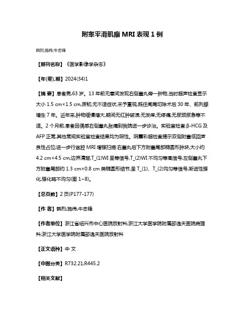 附睾平滑肌瘤MRI表现1例