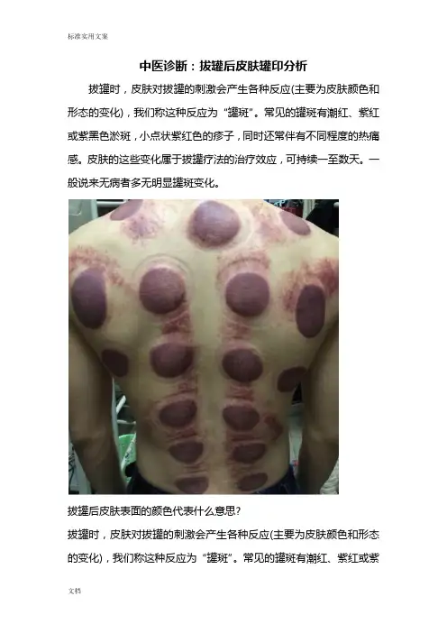 中医诊断：拔罐后皮肤罐印分析报告报告材料