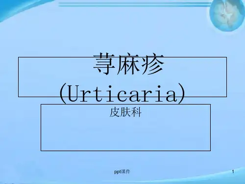 荨麻疹  ppt课件