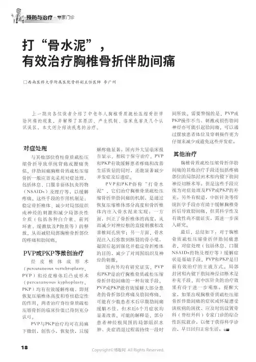 打“骨水泥”，有效治疗胸椎骨折伴肋间痛