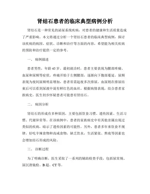 肾结石患者的临床典型病例分析