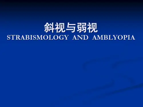 眼科学课件--(斜视)