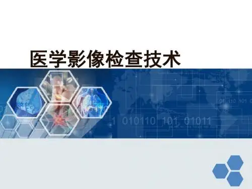 腹部CT检查技术及常见疾病CT表现PPT课件