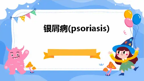 银屑病(Psoriasis)