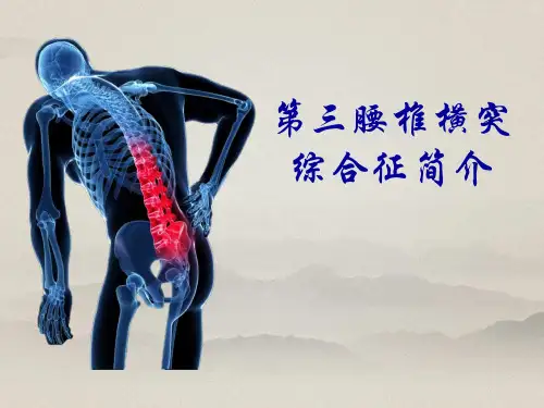 第三腰椎横突综合征 简介